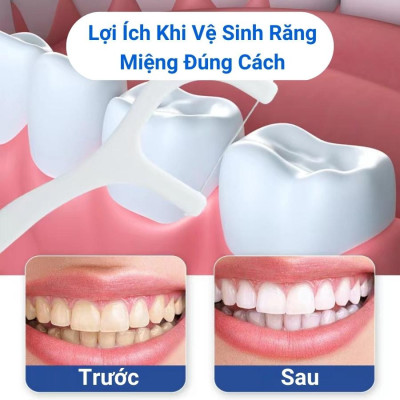 Phụ kiện nhà bếp phòng ăn - Combo  hộp 50 cây tăm chỉ nha khoa ,an toàn dễ sử dụng