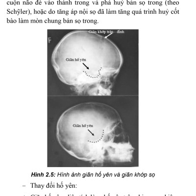 Thực Hành Lâm Sàng Thần Kinh Học - Tập 4: Chẩn Đoán Cận Lâm Sàng (Xuất bản lần thứ hai có sửa chữa, bổ sung)