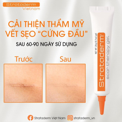 Strataderm 5g - Gel Silicone ngăn ngừa sẹo lồi, sẹo xấu, sẹo lâu năm