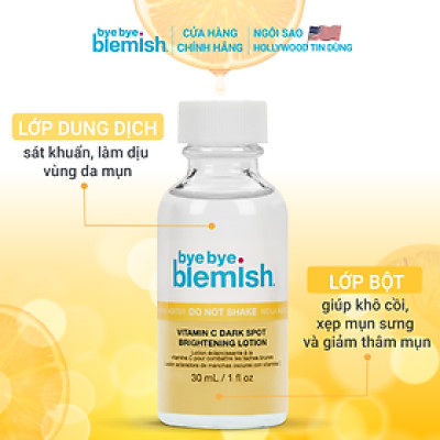 Chấm mụn Bye Bye Blemish Drying Lotion 30ml giảm mụn nhanh sau 1 đêm cho tất cả loại mụn trên mặt và body