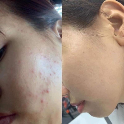 Tinh Chất Sâm Đất Saffron DR CELL 30ml