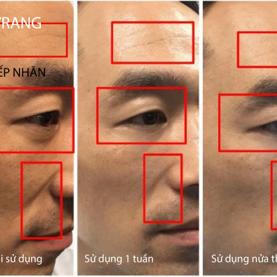 Máy Massage Cầm Tay Chăm Sóc Da Mặt Led Vrang quà tặng hội chị em nhân ngày 20/10