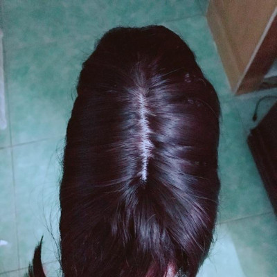 Tóc mái che hói cho nữ- hình thật