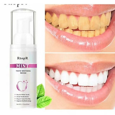 HỘP KEM TẨY TRẮNG RĂNG CAO CẤP CHO MỌI GIA ĐÌNH 