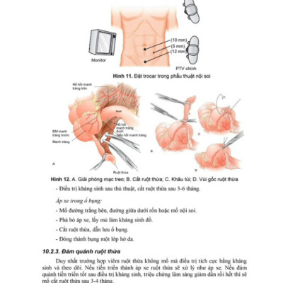 Sách - Bài giảng bệnh học ngoại khoa 2024 (Y)