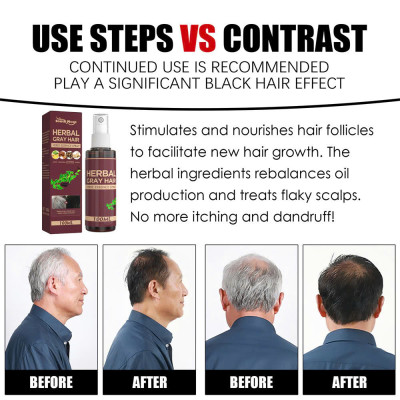 Làm Đen Tóc Vĩnh Viễn Với Thảo Dược – Dưỡng Chất 100ml Cho Mái Tóc Luôn Đen Óng Mượt , đèn ốp trần