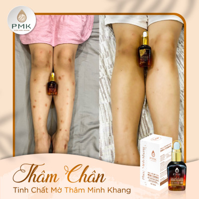 Combo 2 lọ Tinh Chất Mờ Thâm Minh Khang